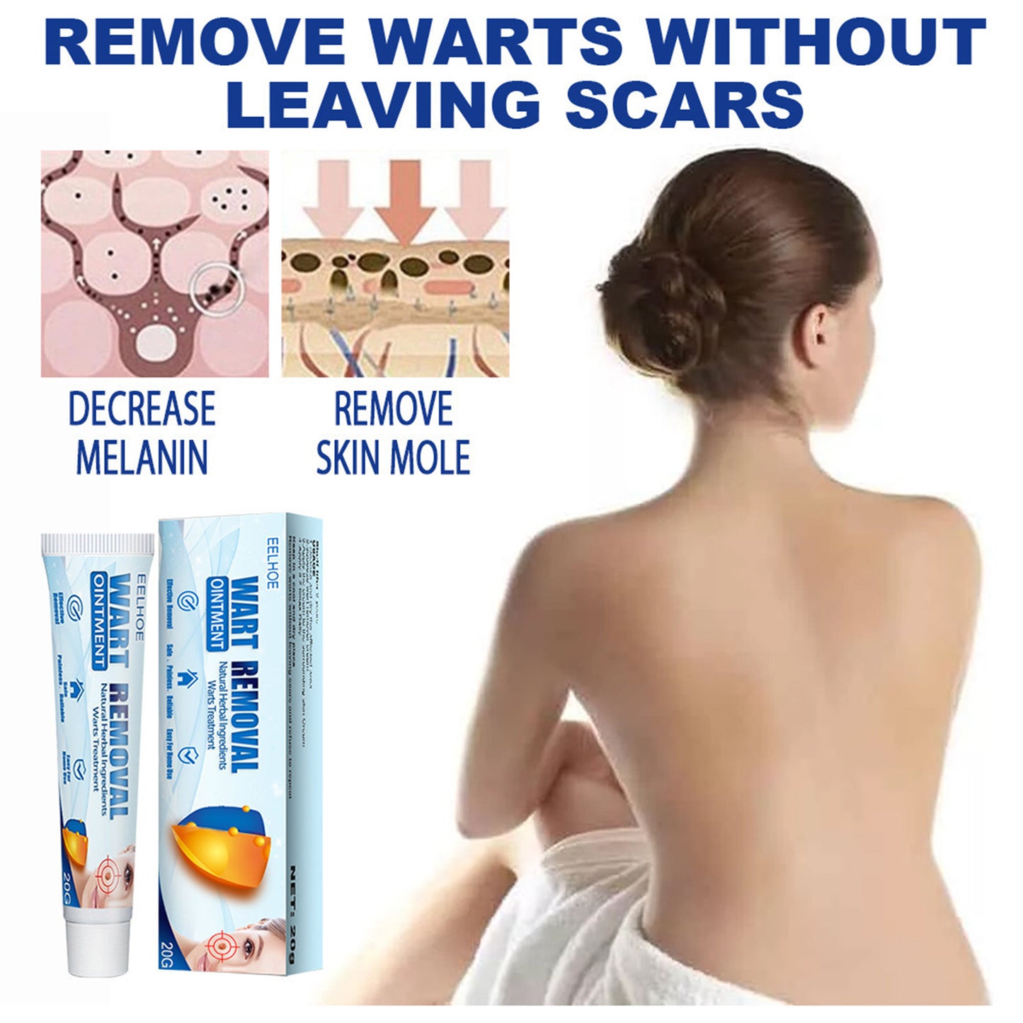 EELHOE Wart & Skin Tag Removal Cream – Herbal Skin Repair for Hands, Feet, Face & Underarms