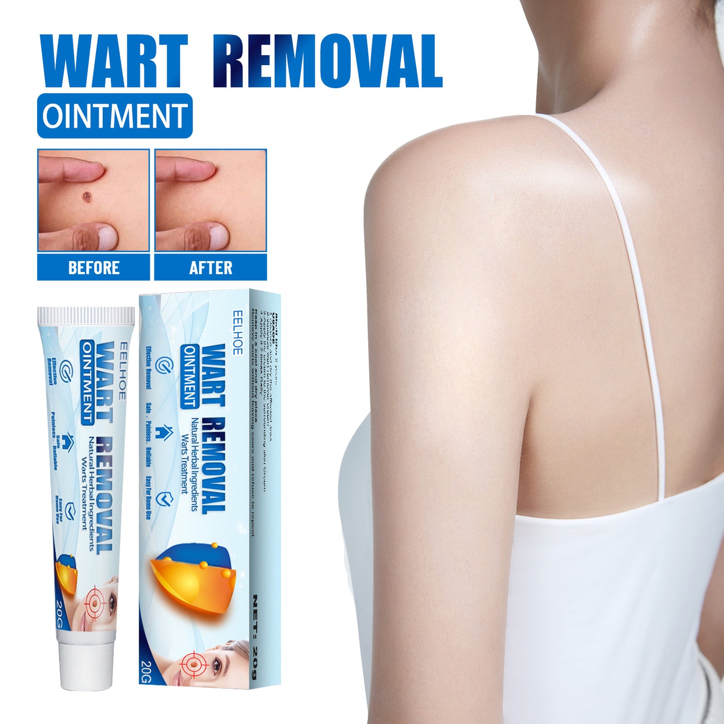 EELHOE Wart & Skin Tag Removal Cream – Herbal Skin Repair for Hands, Feet, Face & Underarms