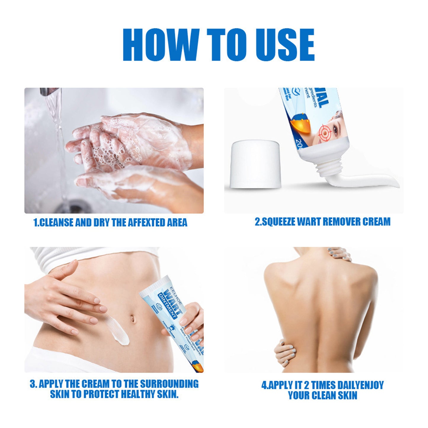 EELHOE Wart & Skin Tag Removal Cream – Herbal Skin Repair for Hands, Feet, Face & Underarms