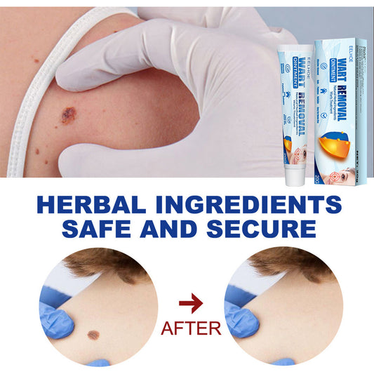 EELHOE Wart & Skin Tag Removal Cream – Herbal Skin Repair for Hands, Feet, Face & Underarms